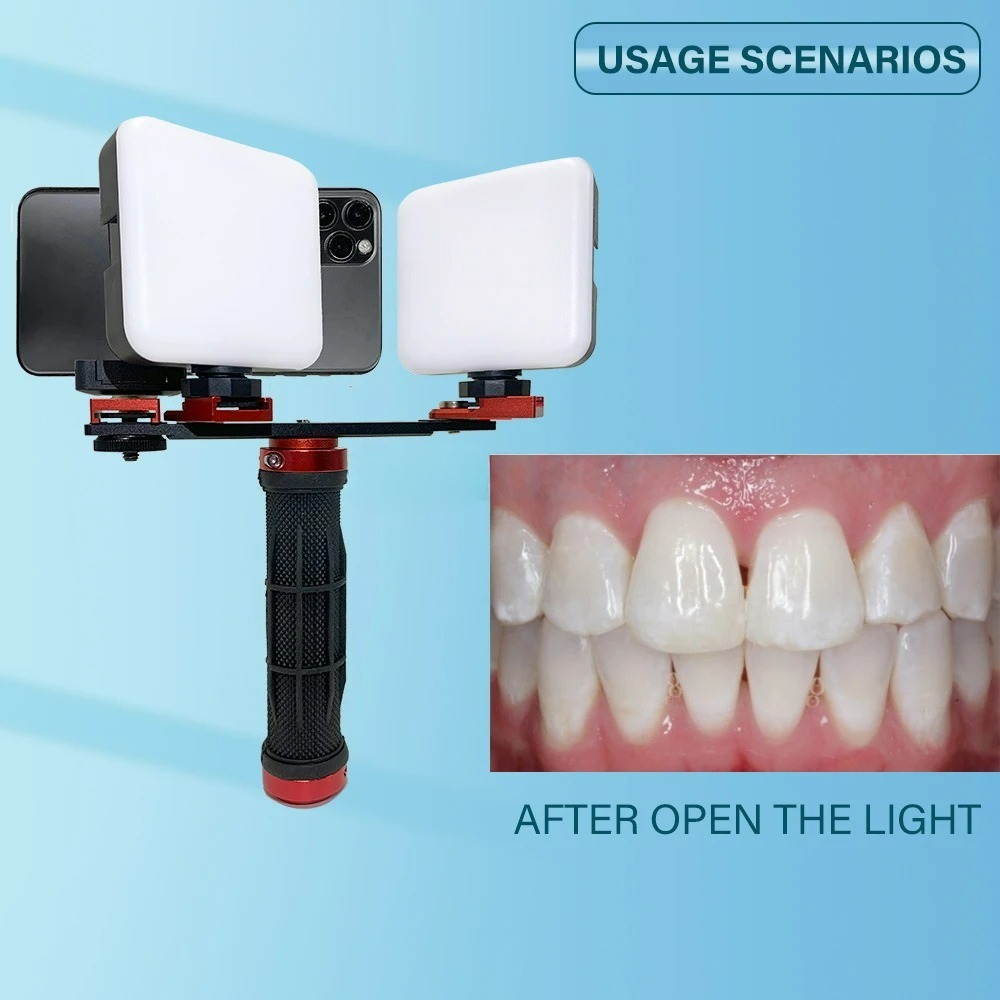 ไฟถ่ายภาพทางทันตกรรมสำหรับโทรศ - Phone Accessories For Photography บทวิจารณ์และราคา